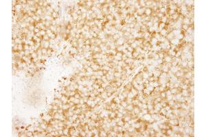 Immunohistochemistry (IHC) image for anti-RpL7a/SURF3 (C-Term) antibody (ABIN7449015) (RpL7a/SURF3 (C-Term) antibody)