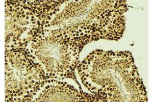 ABIN6276437 at 1/100 staining Mouse testis tissue by IHC-P. (BIRC2 antibody  (C-Term))