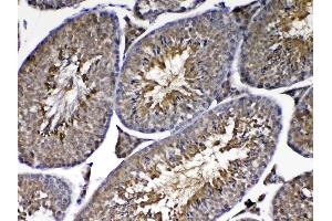Immunohistochemistry (IHC) image for anti-Parkinson Protein 7 (PARK7) (AA 2-189) antibody (ABIN5519050)