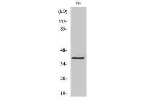 Western Blotting (WB) image for anti-Melanoma Antigen Family C, 2 (MAGEC2) (Internal Region) antibody (ABIN3185441) (MAGEC2 antibody  (Internal Region))