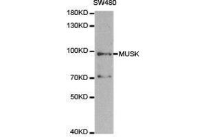 Western Blotting (WB) image for anti-Muscle, Skeletal, Receptor Tyrosine Kinase (MUSK) antibody (ABIN1873783) (MUSK antibody)