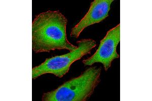 Fluorescent confocal image of Hela cell stained with Tuberin (TSC2) Antibody  (ABIN390324 and ABIN2840755). (Tuberin antibody  (AA 1776-1805))
