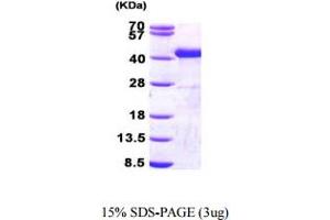 Sorbitol Dehydrogenase (SORD) (AA 1-357) protein (His tag)