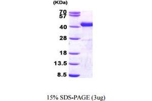 SDS-PAGE (SDS) image for Sorbitol Dehydrogenase (SORD) (AA 1-357) protein (His tag) (ABIN667008) (SORD Protein (AA 1-357) (His tag))