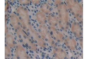 Immunohistochemistry (IHC) image for anti-Fms-Related tyrosine Kinase 3 (FLT3) (AA 335-544) antibody (ABIN7443014)