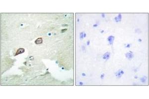 Immunohistochemistry analysis of paraffin-embedded human brain tissue, using HER3 (Ab-1222) Antibody. (ERBB3 antibody  (AA 1191-1240))