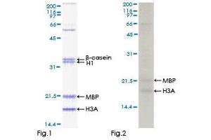 TP53RK Protein (AA 1-253) (GST tag)