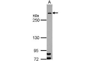 WB Image Sample (30 ug of whole cell lysate) A: HeLa nucleus 5% SDS PAGE antibody diluted at 1:1000 (MDC1 antibody)