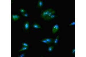 Immunofluorescent analysis of Hela cells using ABIN7161979 at dilution of 1:100 and Alexa Fluor 488-congugated AffiniPure Goat Anti-Rabbit IgG(H+L) (NOP58 antibody  (AA 1-529))