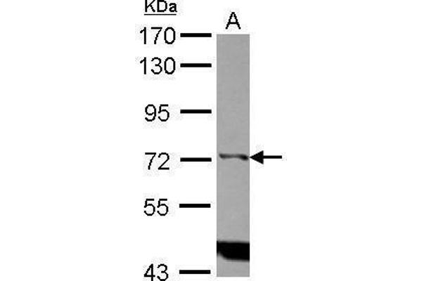 ITPKC antibody