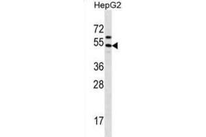 Western Blotting (WB) image for anti-Grainyhead-Like 1 (GRHL1) antibody (ABIN2998692) (GRHL1 antibody)