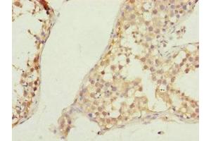 Immunohistochemistry of paraffin-embedded human testis tissue using ABIN7147449 at dilution of 1:100 (CSPP1 antibody  (AA 997-1256))