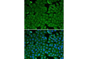 Immunofluorescence analysis of HeLa cell using SPINK1 antibody.