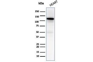 Western blot analysis of Heart tissue lysate using N-Cadherin Mouse Monoclonal Antibody (13A9). (N-Cadherin antibody  (Cytoplasmic Domain))