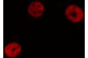 ABIN6274297 staining HeLa cells by IF/ICC. (DLX5 antibody  (Internal Region))