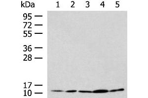 Western blot analysis of HL-60 Hela Jurkat LNCAP HepG2 cell lysates using PAM16 Polyclonal Antibody at dilution of 1:900 (MAGMAS antibody)