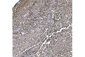 IHC analysis of Elongin-C/ELOC using anti-Elongin-C/ELOC antibody (ABIN7598951).