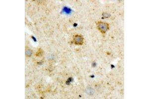 Immunohistochemical analysis of GRK3 staining in human brain formalin fixed paraffin embedded tissue section. (ADRBK2 antibody)