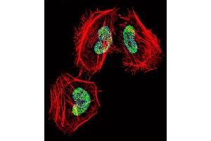 Fluorescent confocal image of Hela cell stained with HDAC4 Antibody (C-term) (ABIN657638 and ABIN2846634). (HDAC4 antibody  (C-Term))