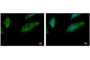 ICC/IF Image CoCoA antibody [N2C2], Internal detects CALCOCO1 protein at cytoplasm by immunofluorescent analysis. (CALCOCO1 antibody)