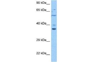 Host:  Rabbit  Target Name:  TMEM173  Sample Tissue:  Human 786-0 Whole Cell  Antibody Dilution:  1ug/ml (STING/TMEM173 antibody  (Middle Region))