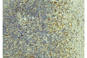 ABIN6276600 at 1/100 staining Human lymph tissue by IHC-P.