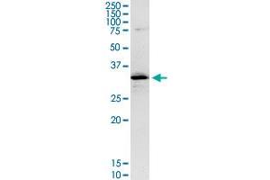 CENPH MaxPab rabbit polyclonal antibody. (CENPH antibody  (AA 1-247))