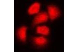 Immunofluorescent analysis of ASC-1 staining in Hela cells. (TRIP4 antibody)