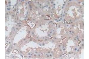 IHC-P analysis of Human Kidney Tissue, with DAB staining. (P-Selectin antibody  (AA 198-432))