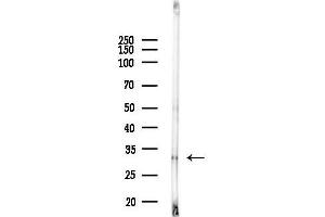 anti-Mitochondrial Carrier 2 (MTCH2) (C-Term) antibody