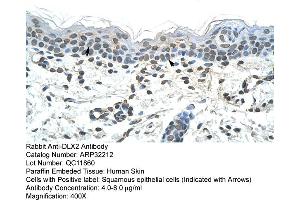 Human Skin (DLX2 antibody  (C-Term))