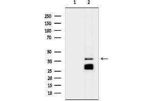 anti-Six Transmembrane Epithelial Antigen of The Prostate 1 (STEAP1) (N-Term) antibody