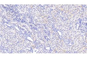Immunohistochemistry (IHC) image for anti-Agrin (AGRN) (AA 1329-1548) antibody (ABIN7444844)
