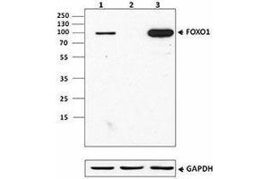 Western Blotting (WB) image for anti-Forkhead Box O1 (FOXO1) antibody (ABIN2664978) (FOXO1 antibody)