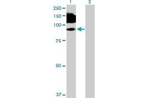 Western Blotting (WB) image for anti-Melanoma Cell Adhesion Molecule (MCAM) (AA 1-646) antibody (ABIN517768)