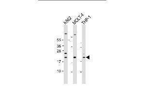 All lanes : Anti-AIF1 Antibody (N-term) at 1:2000 dilution Lane 1: K562 whole cell lysate Lane 2: MOLT-4 whole cell lysate Lane 3: THP-1 whole cell lysate Lysates/proteins at 20 μg per lane. (Iba1 antibody  (N-Term))