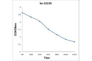Antigen: 2 µg/100 µL  Primary: Antiserum, 1:500, 1:1000, 1:2000, 1:4000, 1:8000, 1:16000, 1:32000;  Secondary: HRP conjugated Rabbit Anti-Goat IgG at 1: 5000;  TMB staining Read the data in Microplate Reader by 450nm. (LIPE antibody  (pSer863))