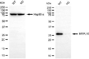 anti-Mitochondrial Ribosomal Protein L10 (MRPL10) antibody
