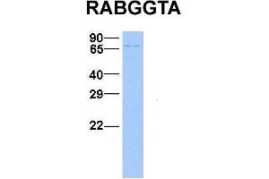 Host:  Rabbit  Target Name:  RABGGTA  Sample Type:  Hela  Antibody Dilution:  1. (RABGGTA antibody  (N-Term))