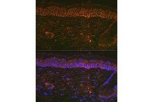 Immunofluorescence analysis of Mouse tail and ear using Cytokeratin 16 (KRT16) Rabbit mAb (ABIN7268094) at dilution of 1:100 (40x lens). (KRT16 antibody)