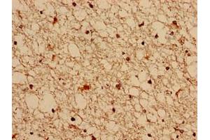 Immunocytochemistry analysis of human brain tissue using ABIN7153269 at dilution of 1:100 (FGD6 antibody  (AA 1138-1352))