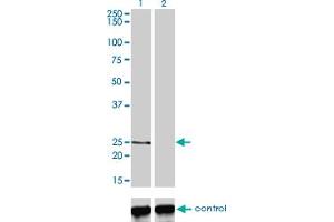 Western blot analysis of PCTP over-expressed 293 cell line, cotransfected with PCTP Validated Chimera RNAi (Lane 2) or non-transfected control (Lane 1). (PCTP antibody  (AA 1-214))