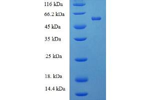 SDS-PAGE (SDS) image for Protein tyrosine Phosphatase, Receptor Type, R (PTPRR) (AA 1-412), (full length) protein (His-SUMO Tag) (ABIN4975767)