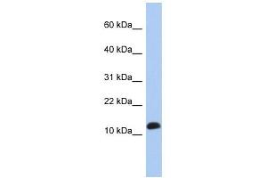 RPL30 antibody used at 1 ug/ml to detect target protein. (RPL30 antibody  (Middle Region))