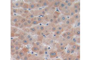 Figure. (SAA2 antibody  (AA 19-122))