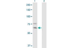 Western Blot analysis of IL2RB expression in transfected 293T cell line by IL2RB MaxPab polyclonal antibody. (IL2 Receptor beta antibody  (AA 1-551))