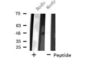Western blot analysis of extracts from HuvEc cells, using ZNF446 antibody. (ZNF446 antibody  (Internal Region))