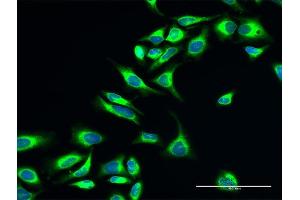 Immunofluorescence (IF) image for anti-Prolyl 4-Hydroxylase, beta Polypeptide (P4HB) (AA 1-508) antibody (ABIN950024)