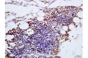 Formalin-fixed and paraffin embedded mouse pancreas labeled with Anti-FAM129A Polyclonal Antibody, Unconjugated (ABIN717701) at 1:200 followed by conjugation to the secondary antibody and DAB staining