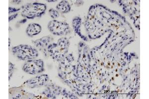Immunoperoxidase of monoclonal antibody to IRF5 on formalin-fixed paraffin-embedded human placenta. (IRF5 antibody  (AA 1-498))